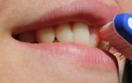 cauzele aparitiei cariilor dentare